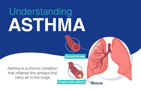 What Causes Mild Persistent Asthma
